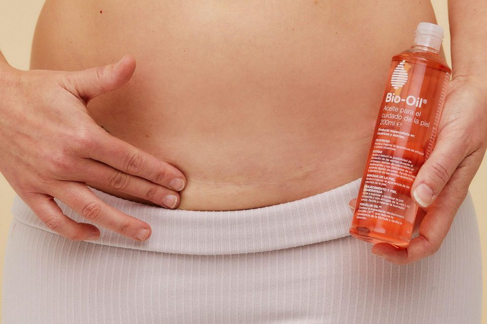 Cómo cuidar tu piel después del embarazo.